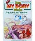 Fractures and Sprains (How My Body Works)